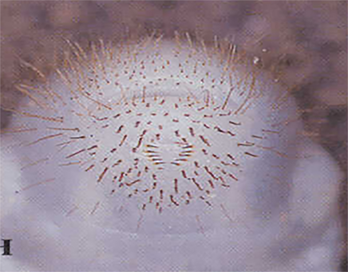 Patrón de pelos en forma de “V” en la región anal de la larva del escarabajo japonés. 